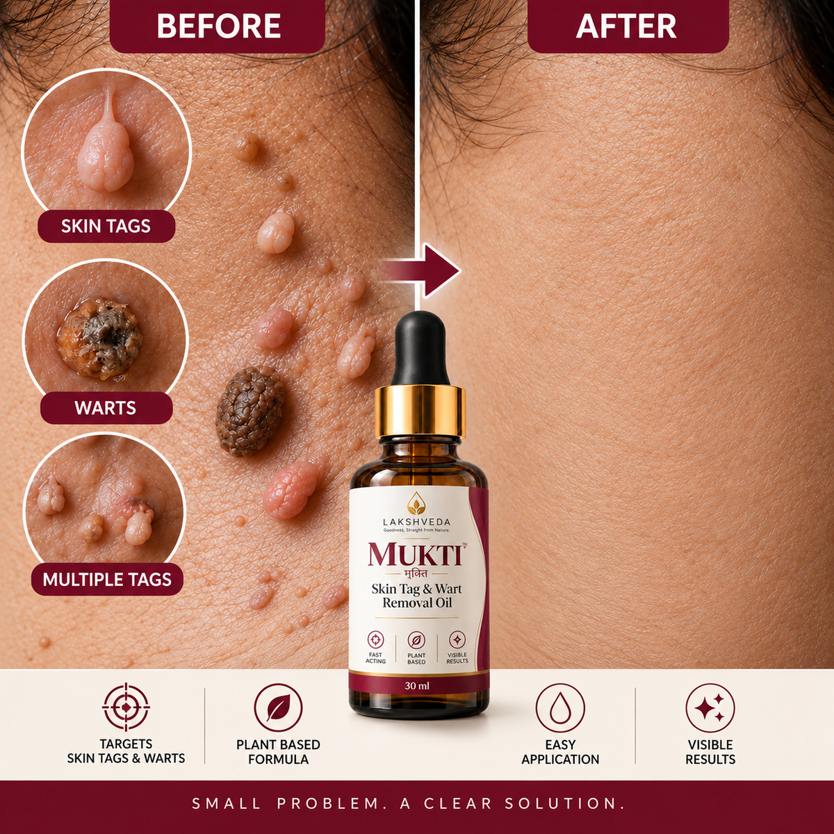Lakshveda's Mukti | Skin Tag remover oil
