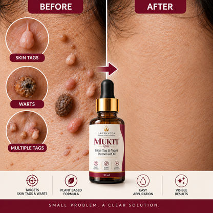 Lakshveda's Mukti | Skin Tag remover oil